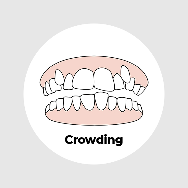Crowding
