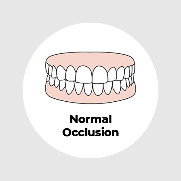 Normal-Occlusion